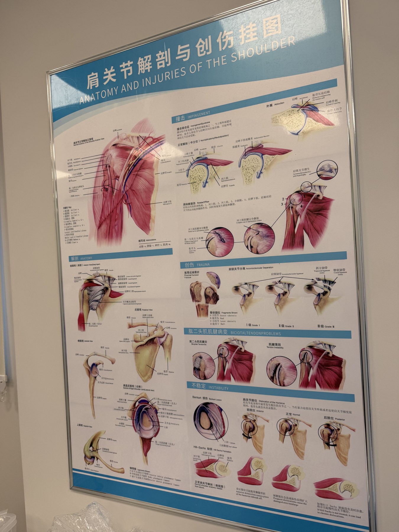 A wall chart explaining shoulder anatomy and injuries
